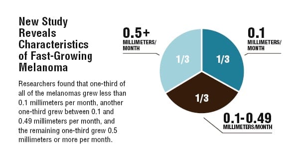 Study Reveals Characteristics of Fast-Growing Melanoma