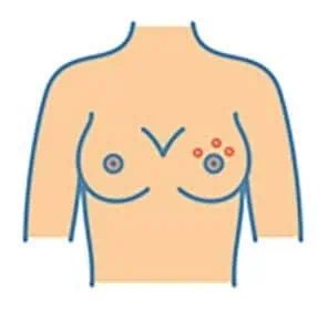 Seriously Skin Cosmetic and Laser Medicine - Your breasts can
